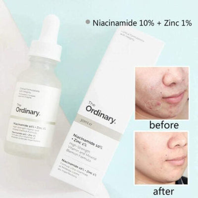 The Ordinary Niacinamide 10% + Zinc 1% – 30ml